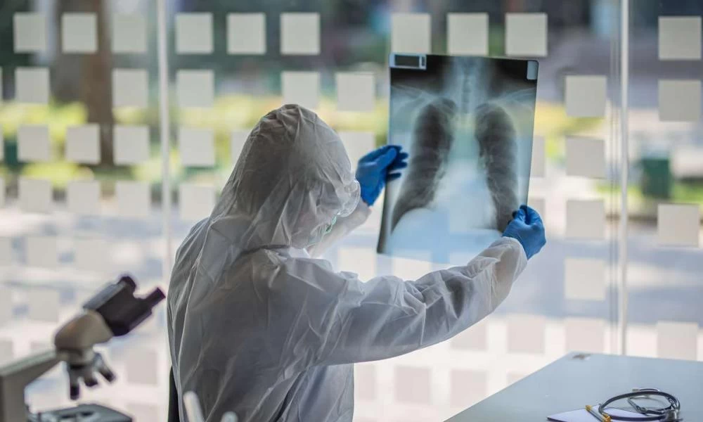 Κορονοϊός: Ενεργά η Ελλάδα σε παγκόσμια κλινική μελέτη για τη θεραπεία